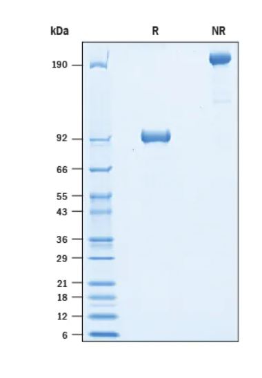 2 μg/lane Protein  was resolved with SDS-PAGE under reducing (R) and non-reducing (NR) conditions and visualized by Coomassie® Blue staining.